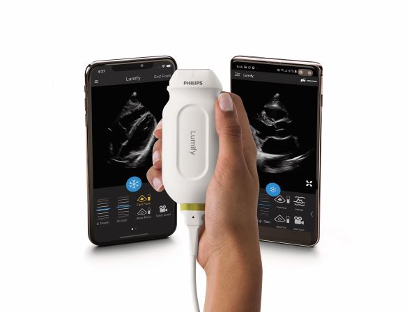 Philips Lumify Handheld S4-1 Phased Array Ultrasound